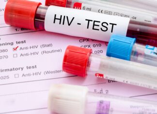 Study Finds Men More Likely Than Women to Transmit HIV Through Heterosexual Contact
