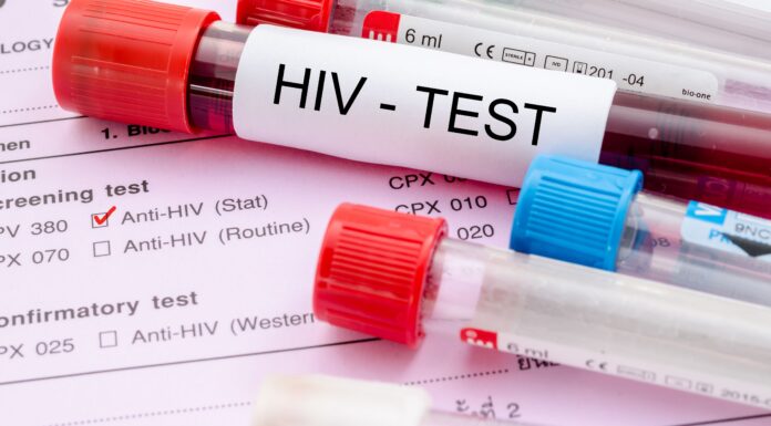 Study Finds Men More Likely Than Women to Transmit HIV Through Heterosexual Contact