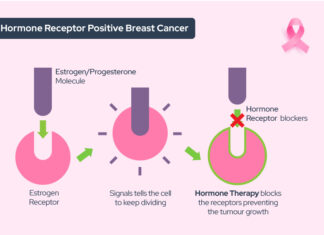 Hormone Regimen May Reduce Risk of Breast Cancer: A Breakthrough in Preventative Care