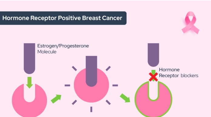 Hormone Regimen May Reduce Risk of Breast Cancer: A Breakthrough in Preventative Care