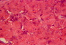 New Breast Cancer Detection Method May Reduce Unnecessary Biopsies