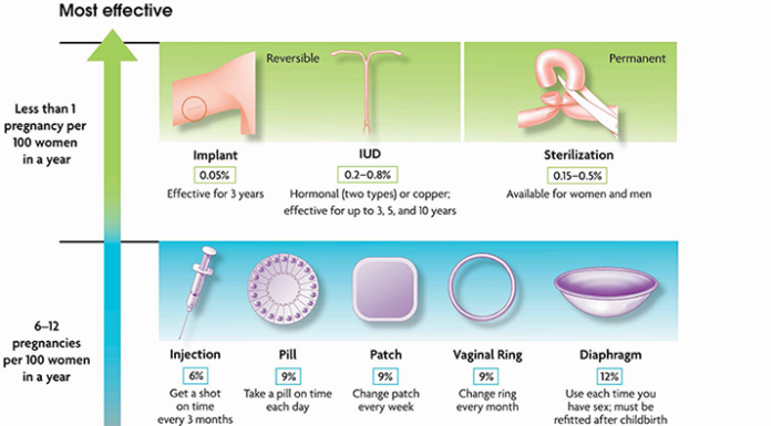 ACOG Recommends IUDs and Implants as First-Line Contraception