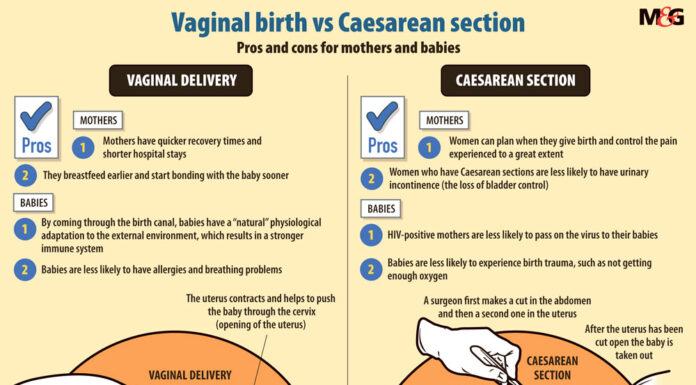 Study Confirms Vaginal Births Safe After Cesarean Sections
