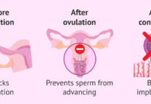 FDA Okays Morning After Pill Procedure: A Major Step for Women’s Reproductive Rights