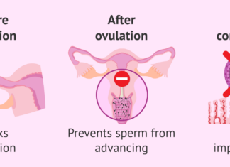 FDA Okays Morning After Pill Procedure: A Major Step for Women’s Reproductive Rights