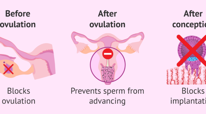 FDA Okays Morning After Pill Procedure: A Major Step for Women’s Reproductive Rights