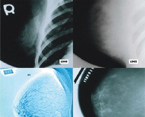 New Research on Mammogram Testing: What Science Says Now