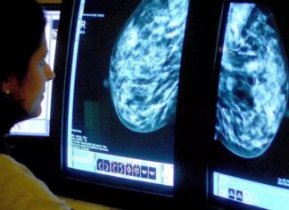 Researchers Discover New Methods to Limit Breast Cancer Tumor Growth