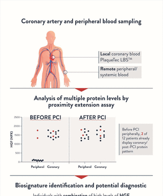 Blood Protein Identified as Increased Heart Risk Factor for Women