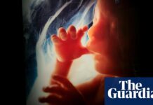 New Study Finds Pollution in Placentas May Threaten Fetal Health