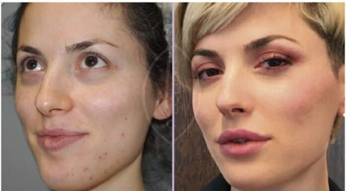 ¿Cómo feminizar tu rostro? Métodos naturales y profesionales