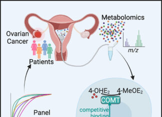 New Screening Technique Improves Uterine Cancer Detection