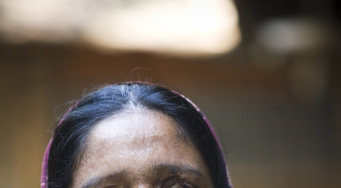 Bangladeshi Women Continue to Face Acid Attacks Despite Laws