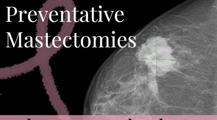 Preventive Mastectomies Found 90% Effective in Reducing Breast Cancer Risk