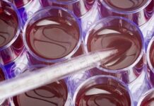 Stem Cell Research Ban Sparks Concern HHS Secretary Calls It ‘Troublesome’