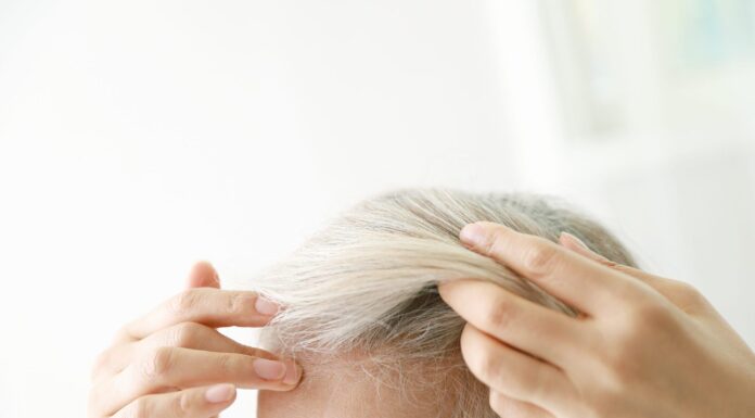 Are Women Attracted to Men with Receding Hairlines? Here’s What They Say