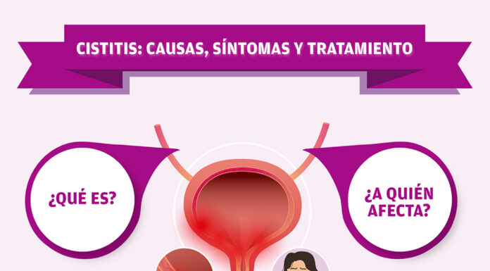 ¿De qué laboratorio es Cisti Fémina? Información útil sobre salud