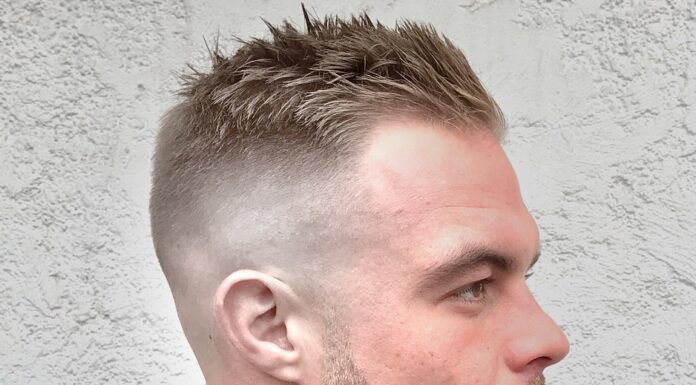 Best Haircuts for Balding Women: Stylish Looks to Boost Your Confidence