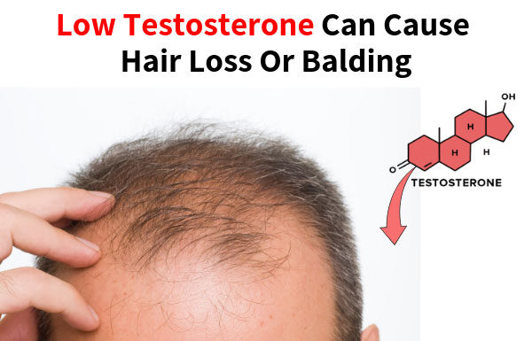 Can Low Testosterone in Women Cause Hair Loss? Hormones & Hair Truths