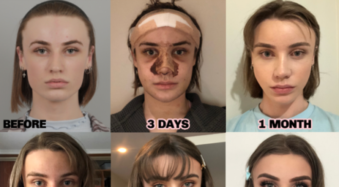 ¿Cómo feminizar tu rostro sin cirugía? Opciones accesibles