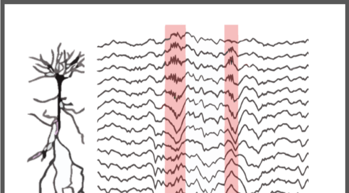 Seychelles’ Feminist Current: Second Wave Ripples on Island Shores